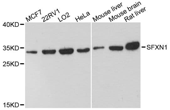 Polyclonal Rabbit anti-Human SFXN1 Antibody (WB)