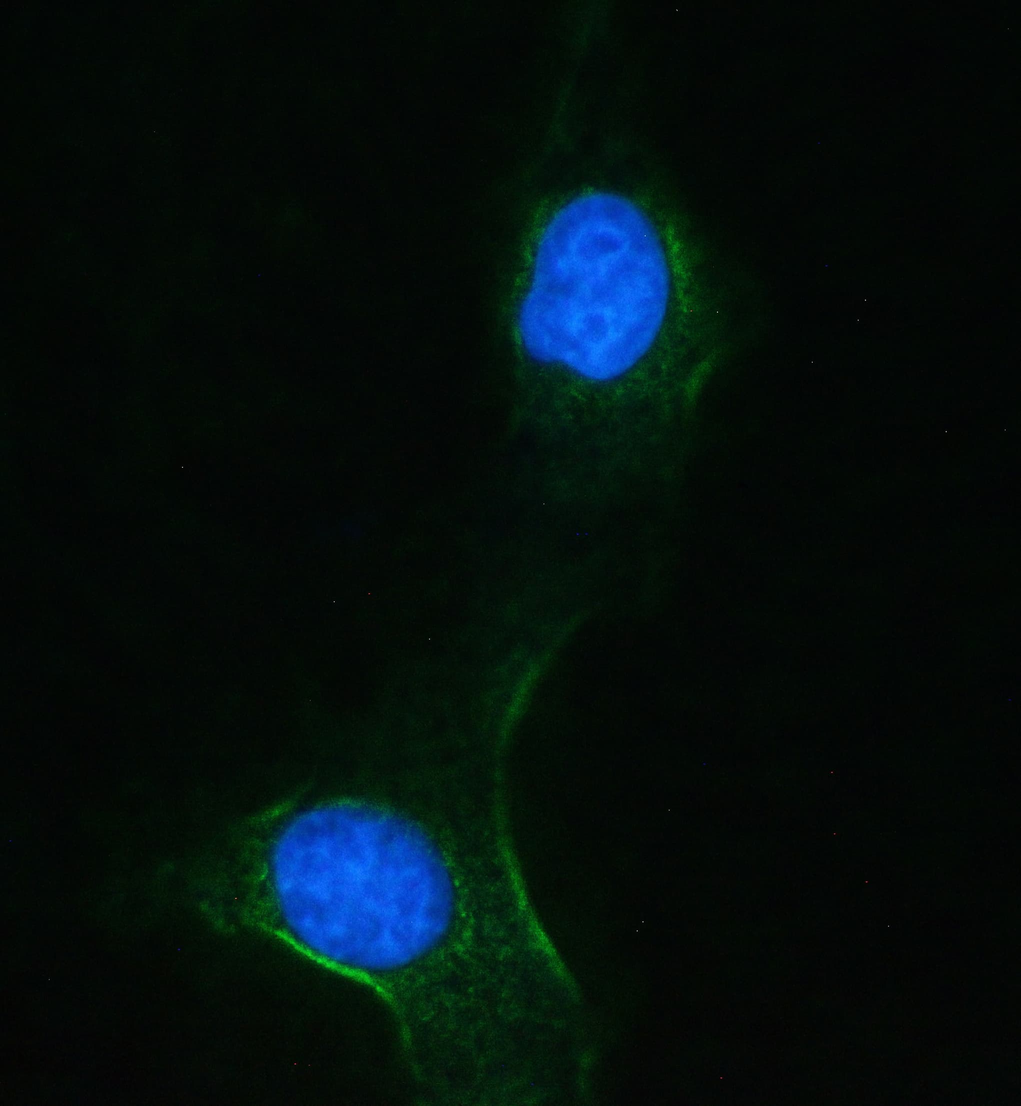 PH / PAH Antibody