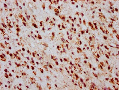 HIST1H2BN Antibody