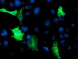 CCM2 / Malcavernin Antibody (clone OTI1B9, Carrier-free)