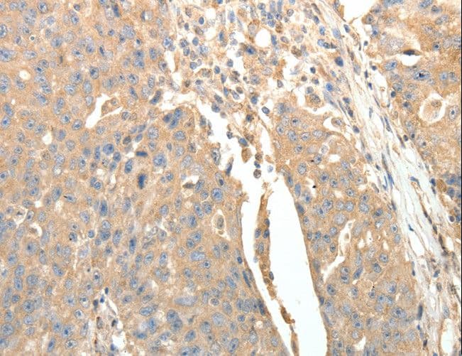 Polyclonal Rabbit anti-Human SFTPD / Surfactant Protein D Antibody (IHC)