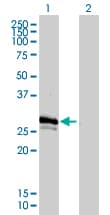 Monoclonal Mouse anti-Human GJB3 / CX31 / Connexin 31 Antibody (clone 3B4-1B3, IF, WB)