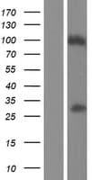 Human PLB1 Protein (Over-Expression Lysate Myc-DDK (Flag))