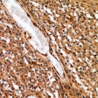 Polyclonal Rabbit anti-Human WRB Antibody (IHC, WB)