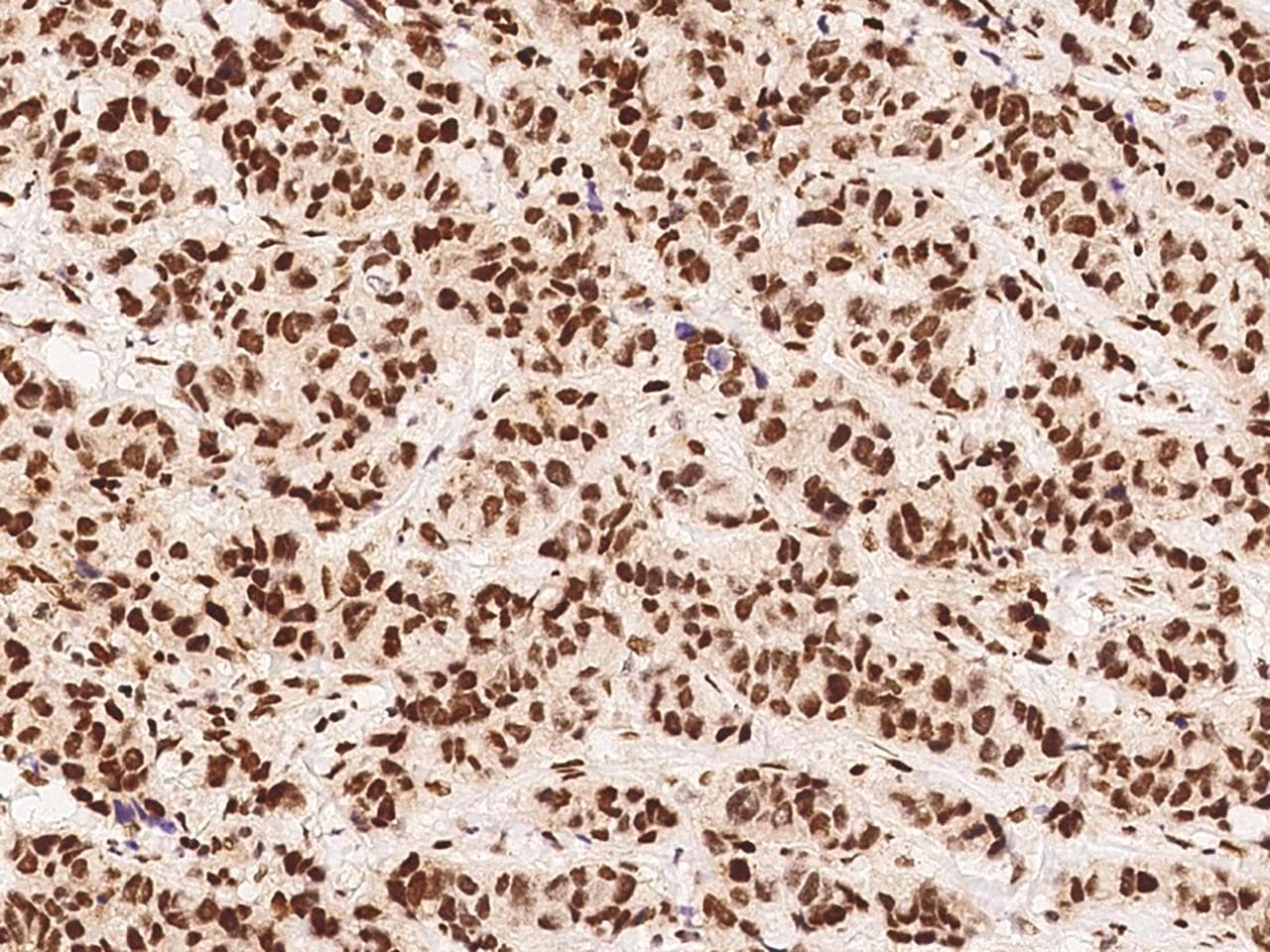 DDB2 Antibody (Preservative Free)