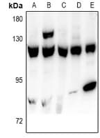 Polyclonal Rabbit anti-Human USP15 Antibody (WB)