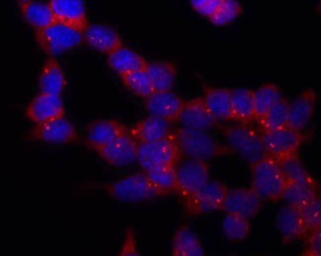 Tubulin Gamma Antibody (Amino Acid: 434-449, clone TU-30)