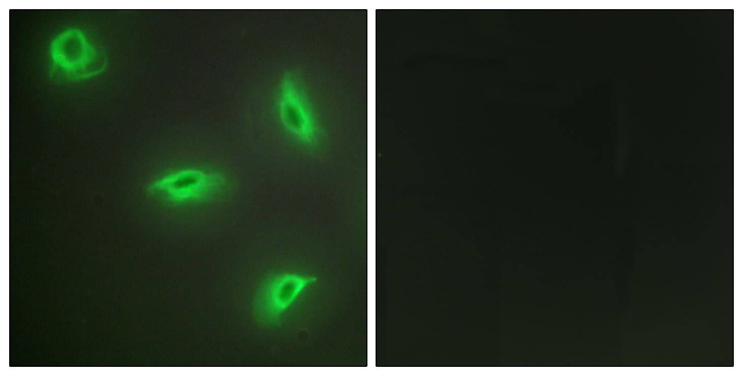 Polyclonal Rabbit anti-Human TNFSF14 / LIGHT Antibody (aa51-100, IF)