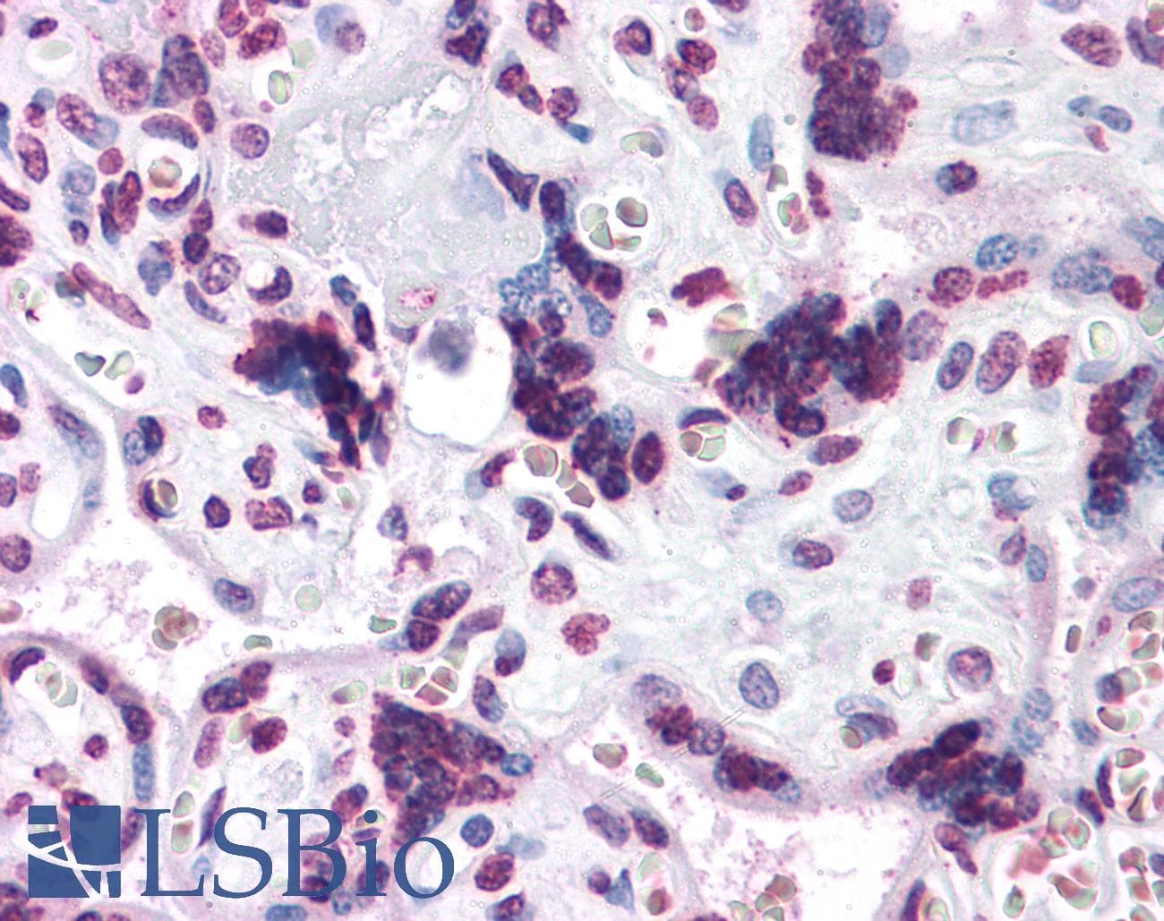 IHC-plus™ CARD14 Antibody