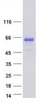 Human KIAA0828 / AHCYL2 Protein (Recombinant Myc-DDK (Flag))