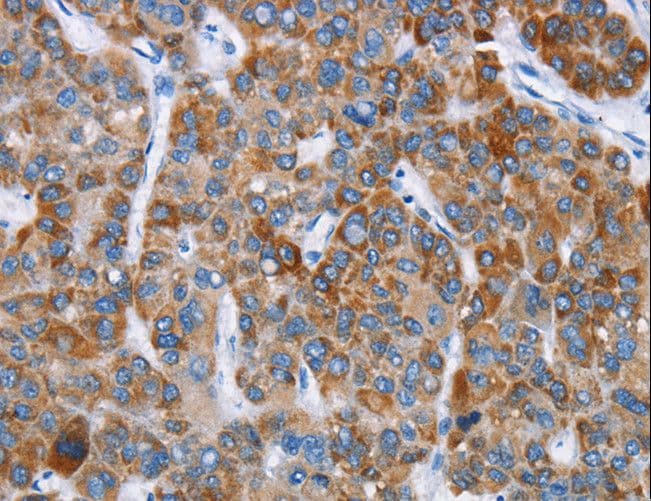 CHDH / CHD Antibody