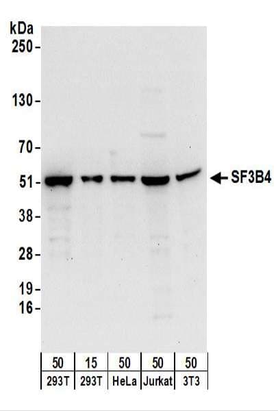 Polyclonal Rabbit anti-Human SF3B4 Antibody (aa374-424, IHC, WB)