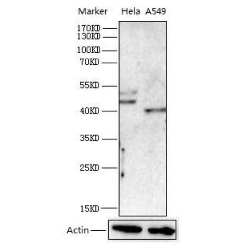 Polyclonal Rabbit anti-Human GSK3B / GSK3 Beta Antibody (1-80 aa, IHC, WB)