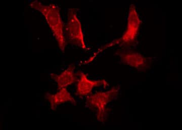 ADORA2B/Adenosine A2B Receptor Antibody