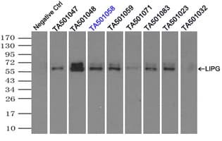 LIPG / Endothelial Lipase Antibody (clone OTI7D1)