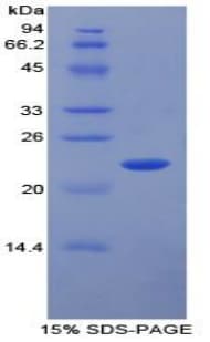 Human MMP13 Protein (Recombinant His)