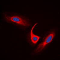 Polyclonal Rabbit anti-Human ACOT4 Antibody (C-Terminus, IHC, IF, WB)