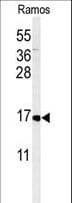 Polyclonal Rabbit anti-Human CMTM7 / CKLFSF7 Antibody (aa13-42, WB)