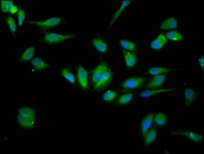 IHC-plus™ HSP90B1 / GP96 / GRP94 Antibody (aa 27-799)