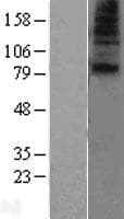 SLC28A1 Protein (Over-Expression Lysate Myc-DDK (Flag))