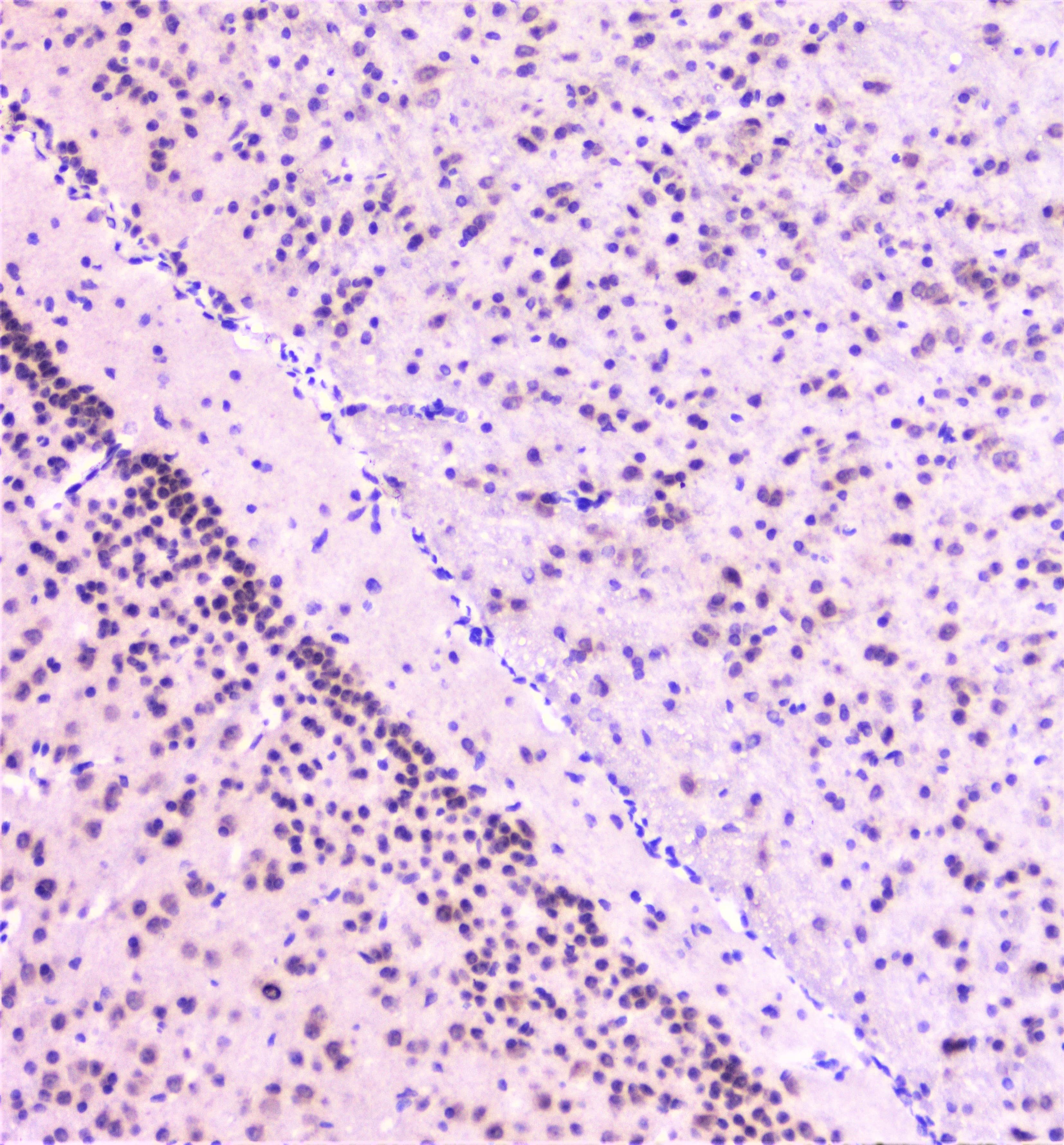 RAD51 / RECA Antibody