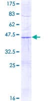 Human CBT1 / SDHD Protein (Recombinant GST)