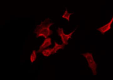 BTLA / CD272 Antibody