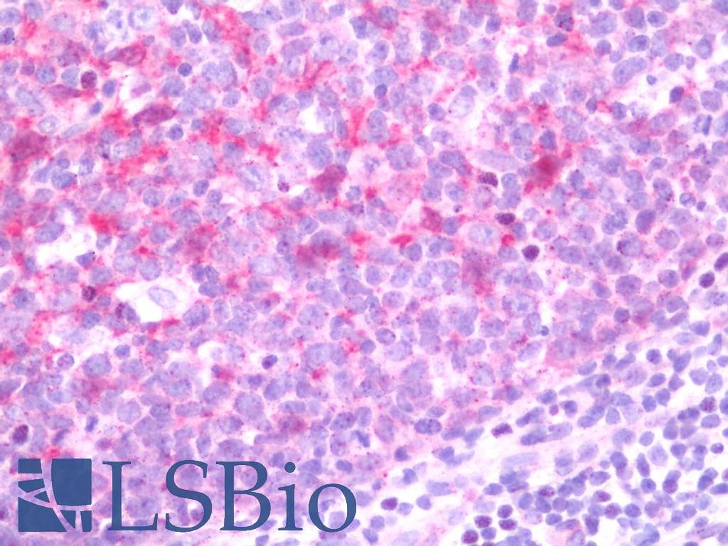 IHC-plus™ Polyclonal Rabbit anti-Human BCL2L11 / BIM Antibody (aa134-160, IHC, WB)
