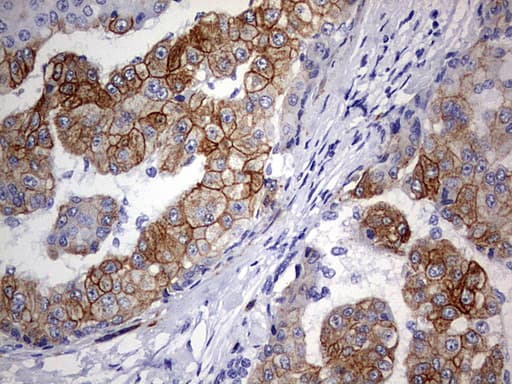 Monoclonal Mouse anti-Human KRT24 / Keratin 24 Antibody (clone OTI4E8, aa139-397, IHC, WB)