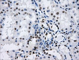 LOX / Lysyl Oxidase Antibody (clone OTI8G5)