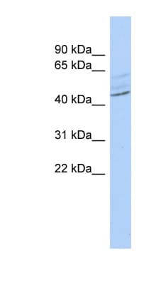 ZMYND12 Antibody (aa251-300)