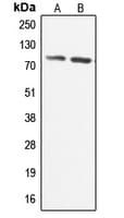 IHC-plus™ ADCK3 / CABC1 Antibody (Internal)