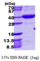 Human AKR1C4 / Chlordecone Reductase Protein (Recombinant His)