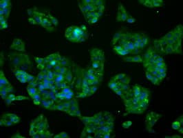 GLUL / Glutamine Synthetase Antibody (clone OTI1F4)