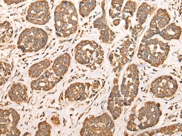 BAIAP2L1 Antibody