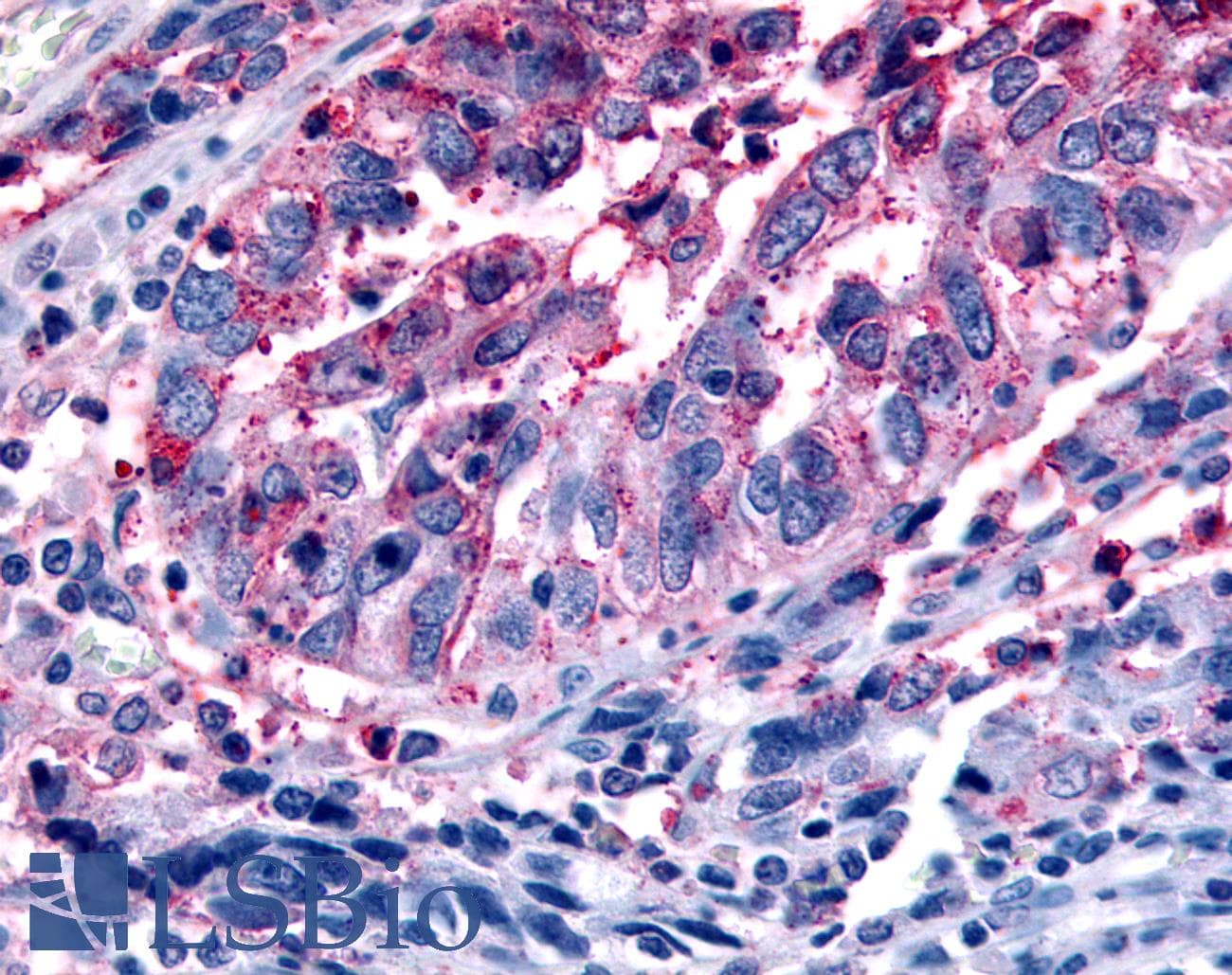 PathPlus™ FFAR2 / GPR43 Antibody (Extracellular Domain)