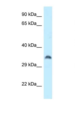 CPPED1 Antibody (aa87-136)