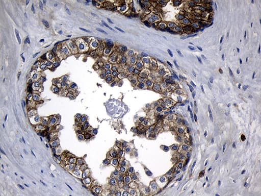 SLC9A1BP / CHP Antibody (clone OTI4B9)