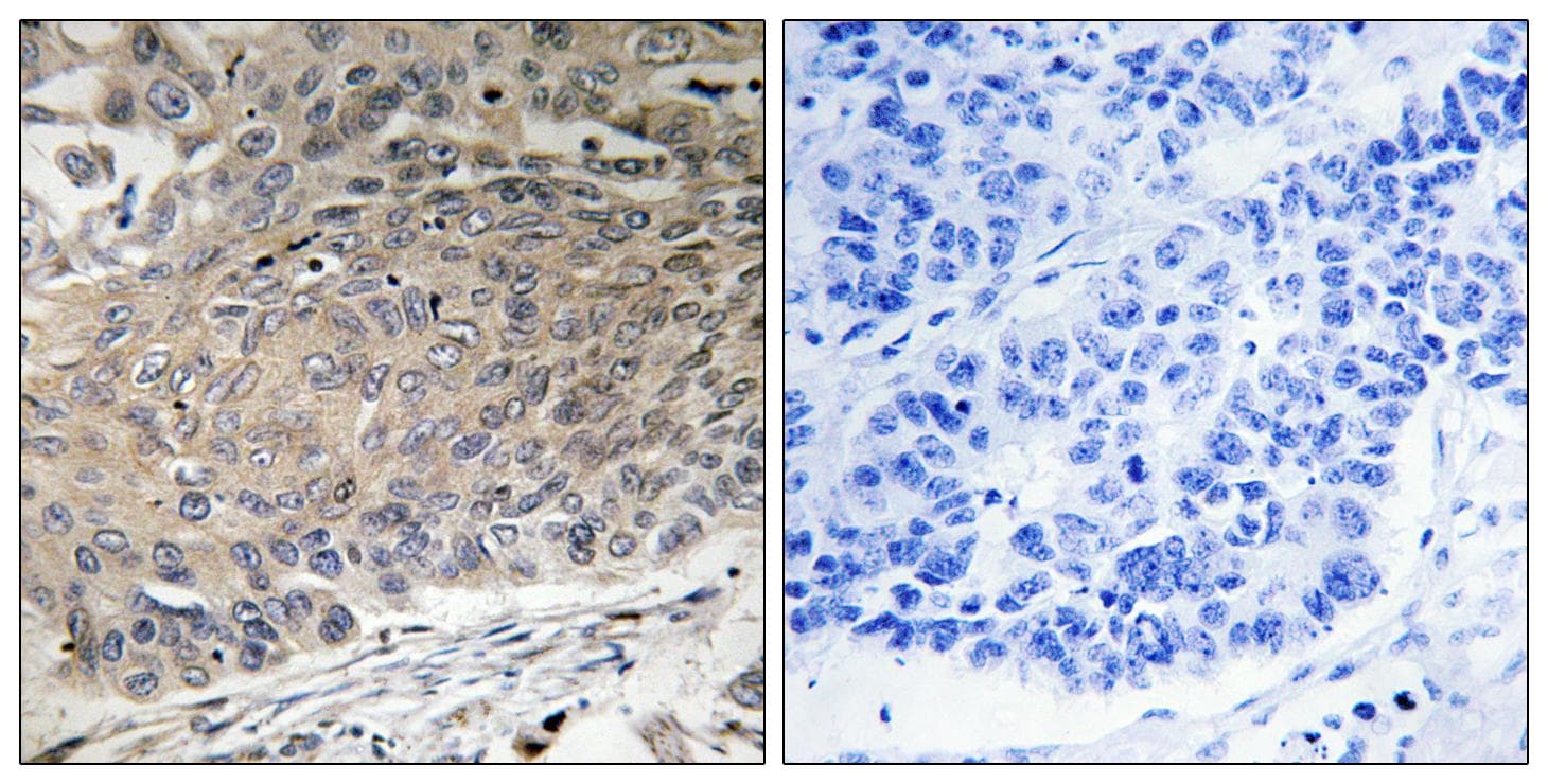 DYNLL2 Antibody (aa1-50)