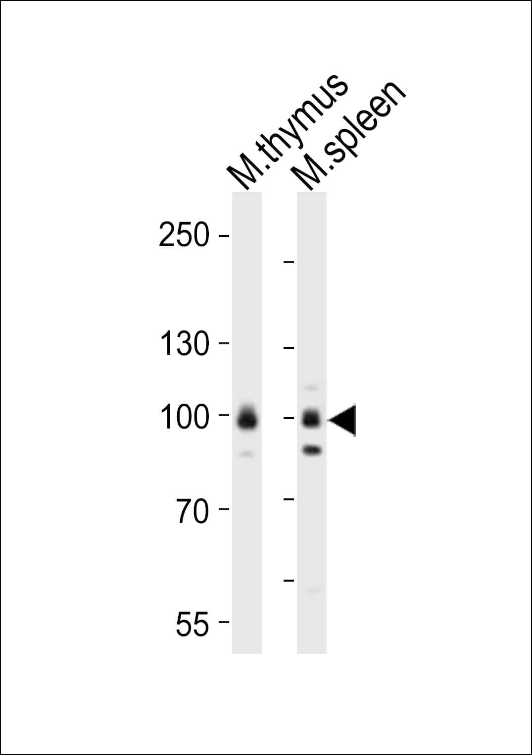 RPS6KA5 / MSK1 Antibody (aa850-883)