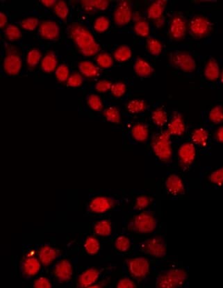 SRF / Serum Response Factor Antibody (phospho-Ser99)