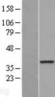Human DOK6 Protein (Over-Expression Lysate Myc-DDK (Flag))