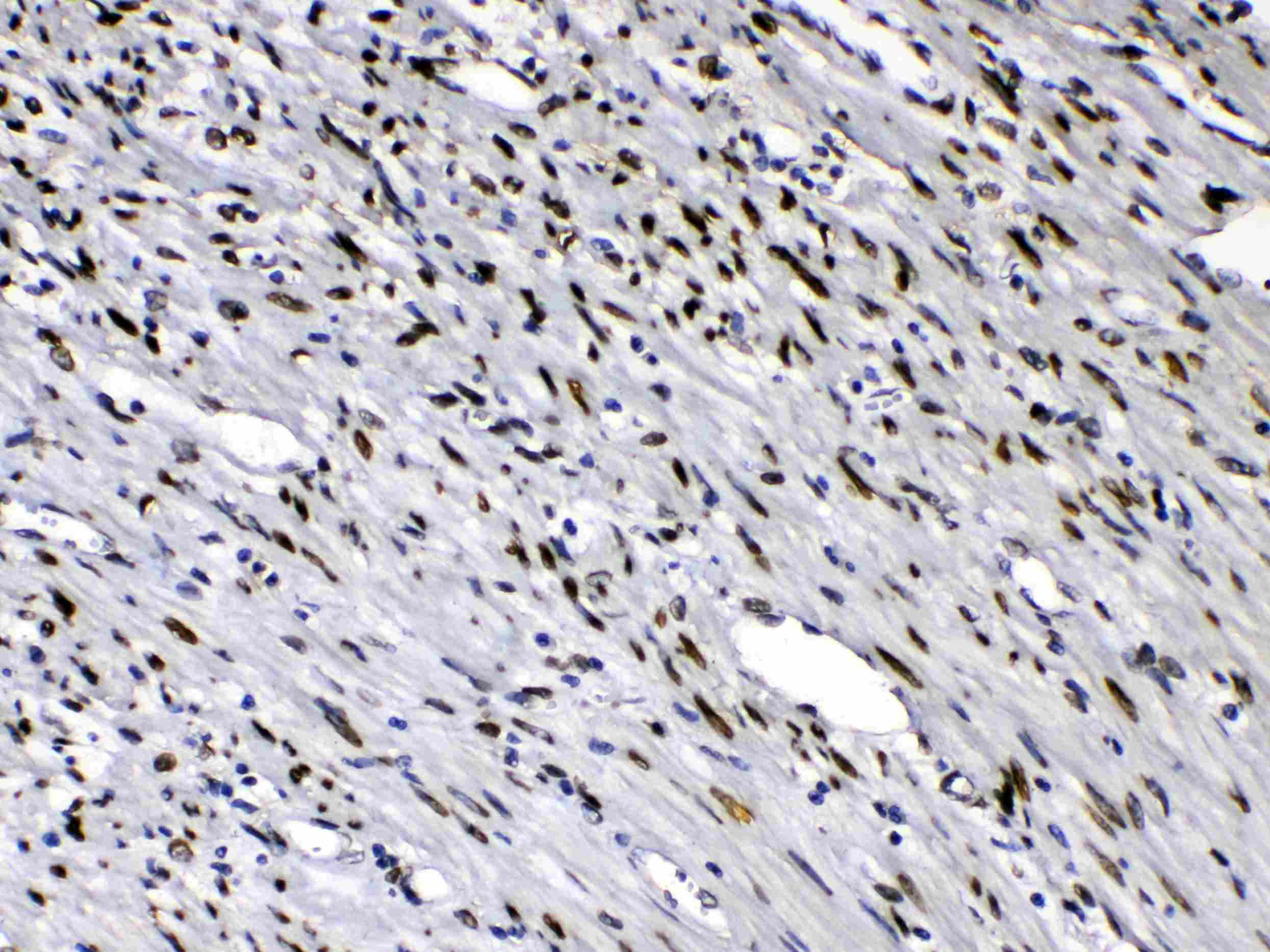 Polyclonal Rabbit anti-Human EMD / Emerin Antibody (IHC, WB)