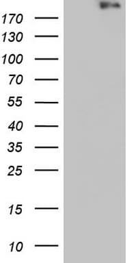 VWF / Von Willebrand Factor Antibody (aa764-1263, clone OTI3B8)