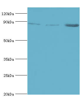 AMPD3 Antibody (aa1-260)