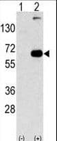 Polyclonal Rabbit anti-Human SQSTM1 Antibody (aa317-346, IHC, IF, WB)