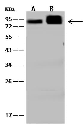 CTTN / Cortactin Antibody