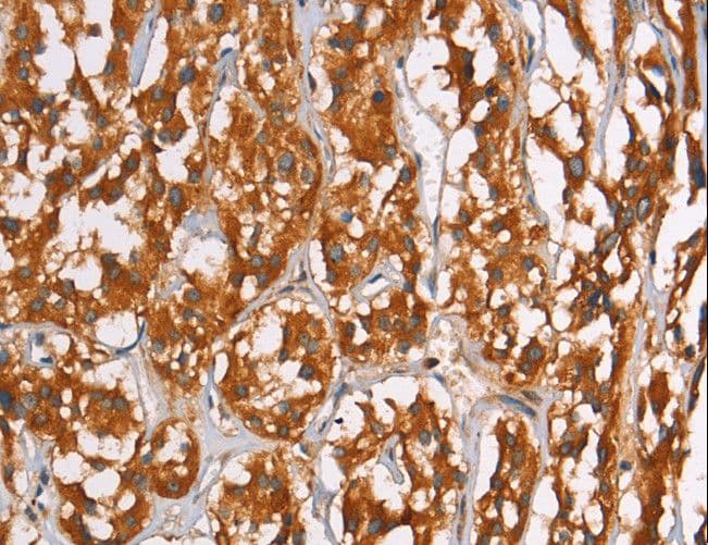 PLIN2 / ADFP / Adipophilin Antibody