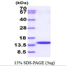 Human CRABP2 Protein (Recombinant)