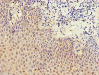 Polyclonal Rabbit anti-Human DEC-205 / CD205 / LY75 Antibody (IHC, WB)